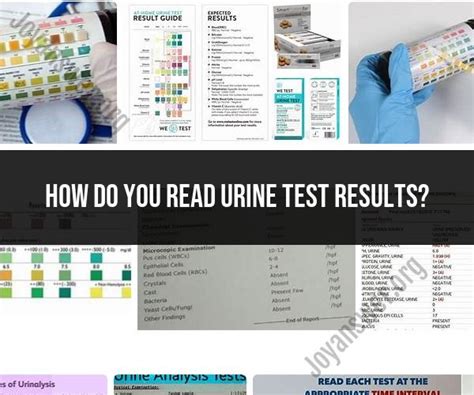 Understanding Urine Test Components