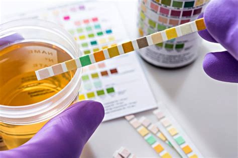 Urine Protein Detection