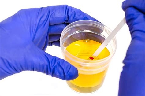 urine testing