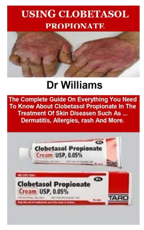 using clobetasol cream