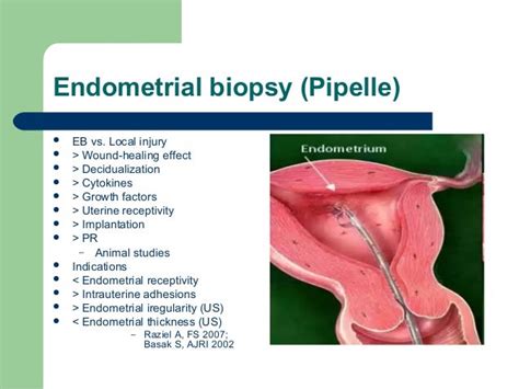 Uterine Lining Biopsy Results