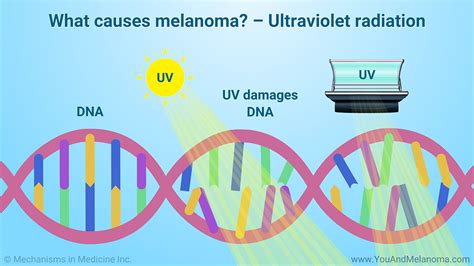 UV Radiation and Melanoma