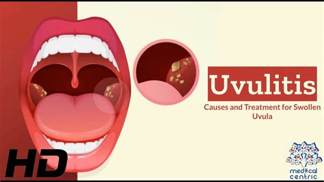 uvula conclusion