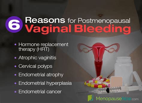 Vaginal Bleeding After Menopause Causes