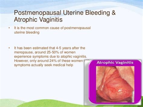 Vaginal Bleeding After Menopause Diagnosis