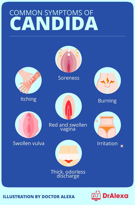 Vaginal Yeast Infection Symptoms