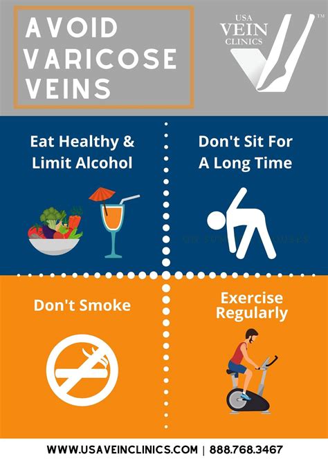 Varicose Veins Prevention