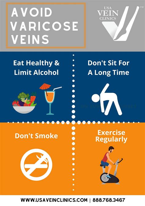varicose veins prevention