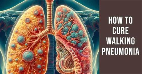 walking pneumonia recovery