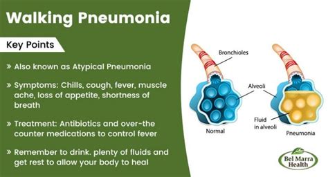 walking pneumonia treatment