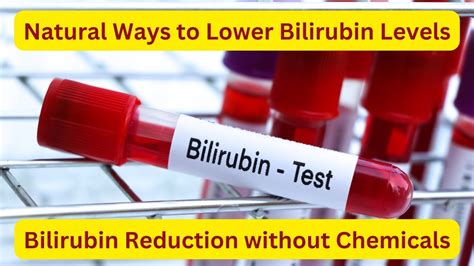ways to manage low bilirubin