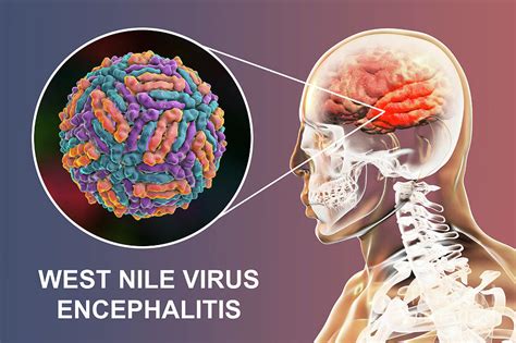 West Nile Encephalitis Transmission