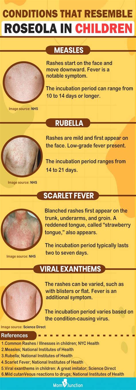 What is Roseola