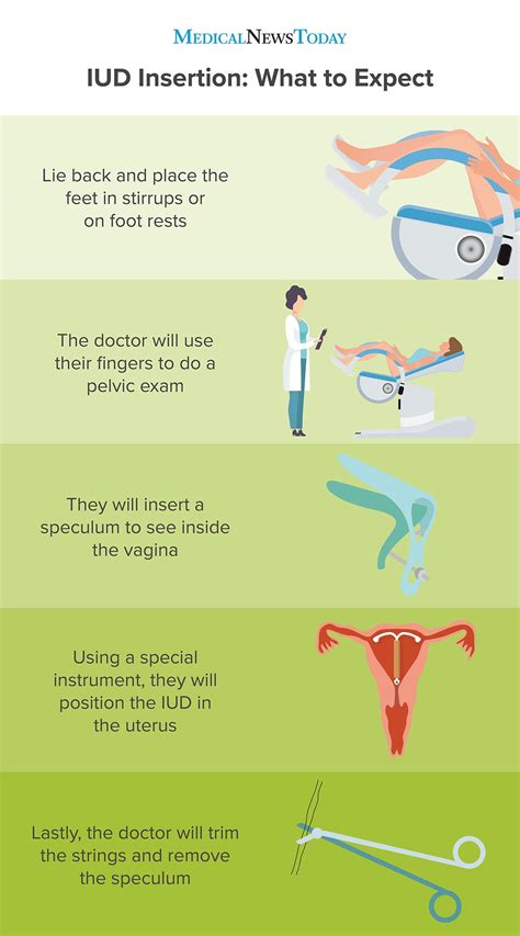 What to Expect After IUD Insertion