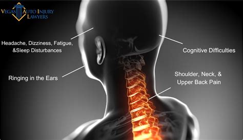 Whiplash Injury Symptoms