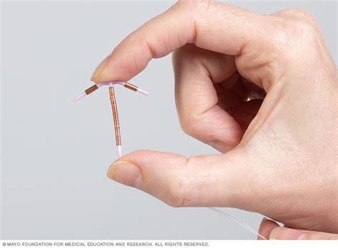Who Can Use Paragard Copper IUD