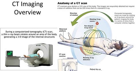 Working mechanism of CT scan angiography