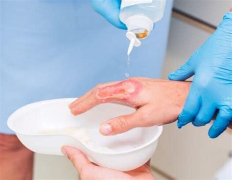 wound cleaning