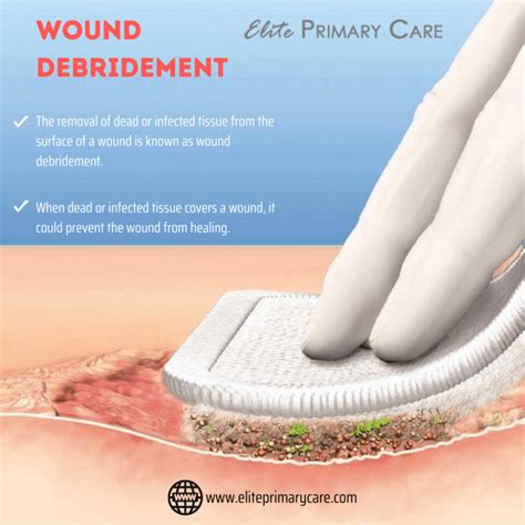 benefits and drawbacks of wound debridement