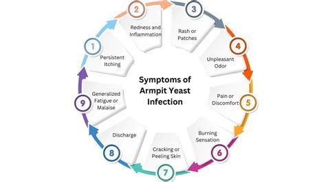 yeast infection